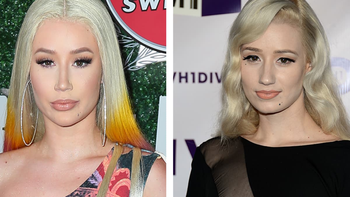 Iggy Azalea Iggy Azalea operiert und früher