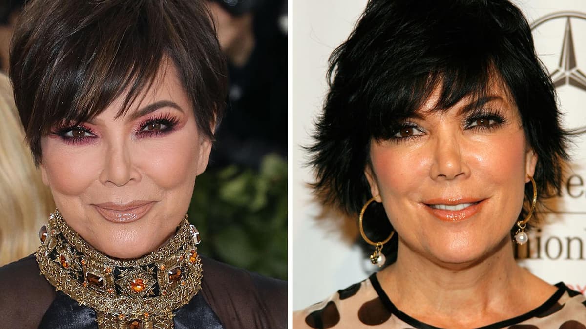 Kris Jenner Kris Jenners Gesicht vor und nach OPs