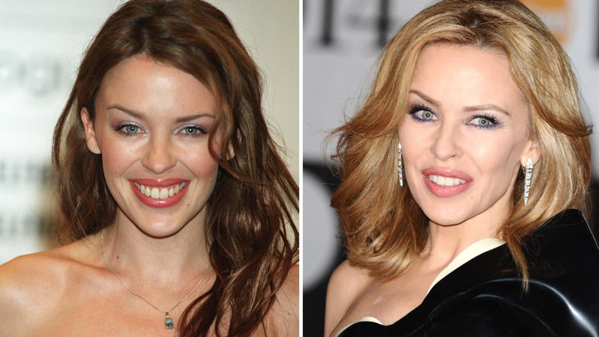 Kylie Minogue Kylie Minogue früher heute