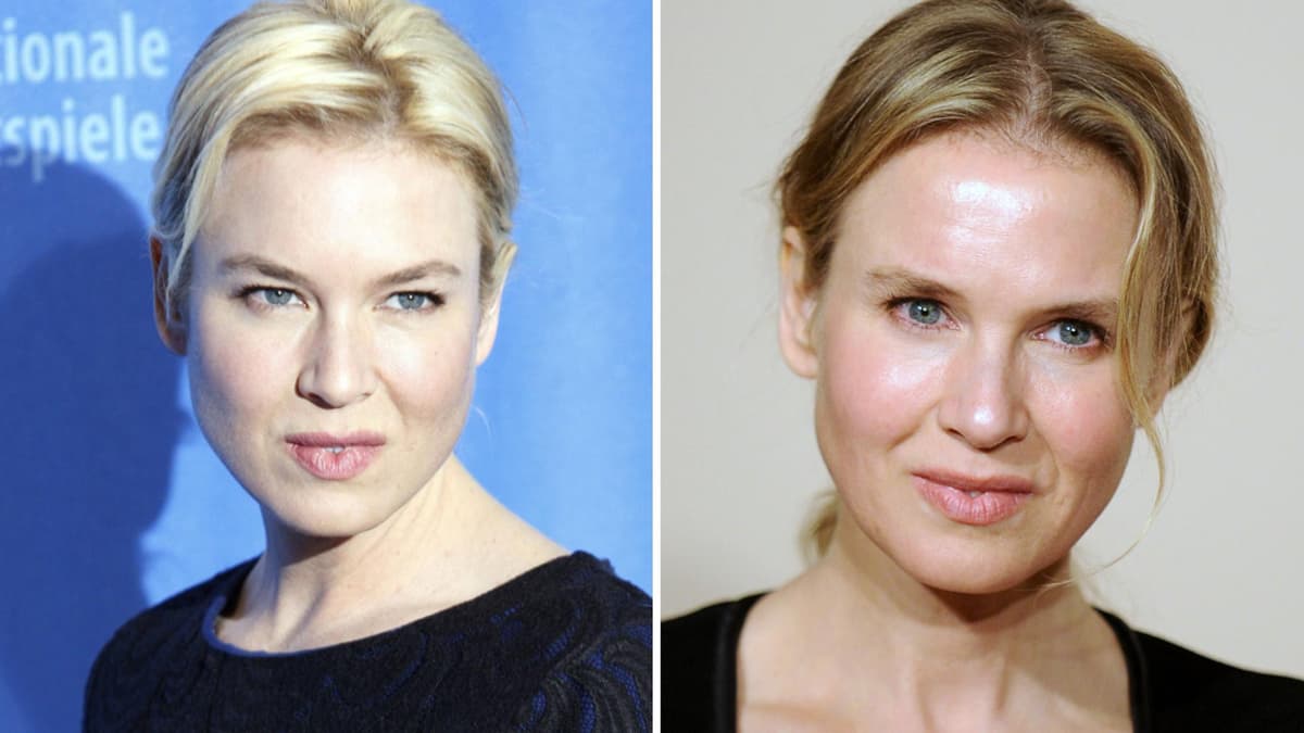 Renée Zwellweger Renée Zwellweger vor und nach Beauty-Eingriff