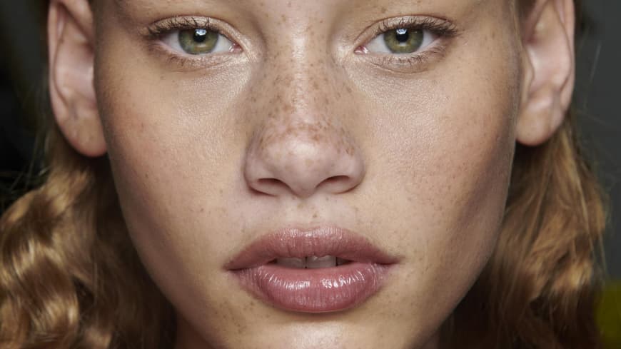 Sonnencreme gegen Pigmentflecken Model mit Sommersprossen