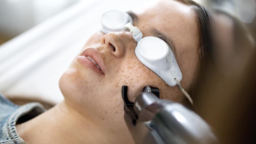 Bio-Boost Behandlung Frau testet den Alma Laser